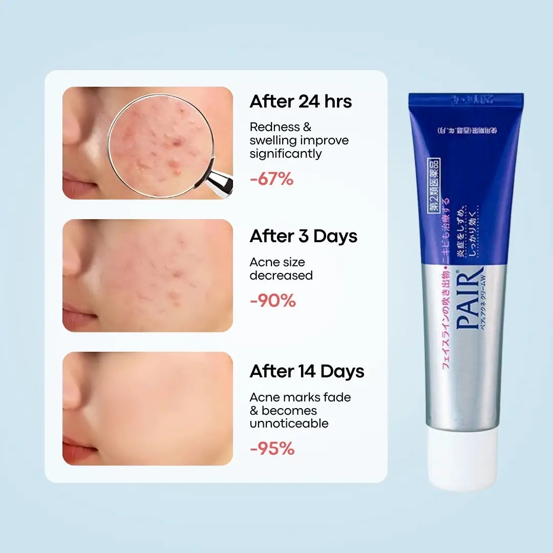 ⁠Lion Pair Acne Cream- 24g