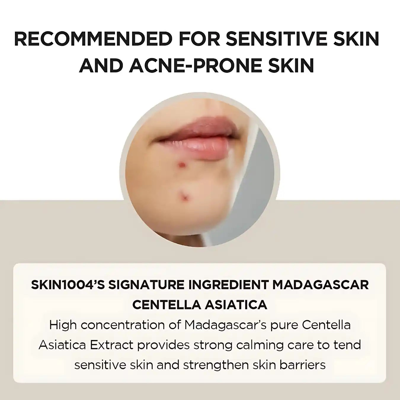 SKIN1004 Madagascar Centella Ampoule (100ml)